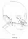 Fig. 27 - Nasal and oral patient interface