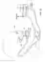 Fig. 29 - Nasal and oral patient interface
