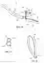 Fig. 31 - Nasal and oral patient interface
