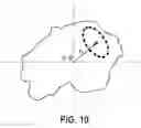 Fig. 11 - IMPEDANCE REGISTRATION AND CATHETER TRACKING