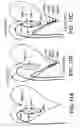 Fig. 12 - IMPEDANCE REGISTRATION AND CATHETER TRACKING