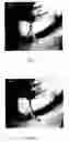 Fig. 07 - Flow Switching on a Multi-Structured Microfluidic Cd (Compact Disc) Using Coriolis Force
