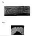 Fig. 04 - Cu—Ni—Si-based copper alloy sheet material and method of manufacturing same