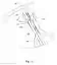 Fig. 11 - Solid stop leaf spring
