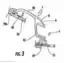 Fig. 03 - Button actuation assembly