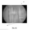 Fig. 08 - Microfluidic separation device and method of making same