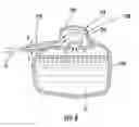 Fig. 04 - METERED DOSING CONTAINER WITH INDEPENDENTLY DEFORMABLE INTERNAL BLADDER