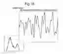 Fig. 09 - Vibration isolation
