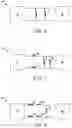 Fig. 03 - System and method for efficient wide dynamic range coil drive