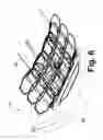 Fig. 07 - Patient Support With Integrated Spine Coil