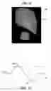 Fig. 08 - Plural light source and camera to detect surface flaws