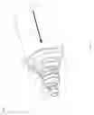 Fig. 04 - Parallel HTS transformer device