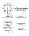 Fig. 03 - In-Ceiling Focus Located Surgical Lighting