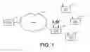 Fig. 02 - Packet aging in a wireless network