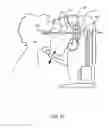 Fig. 05 - Orthovoltage radiotherapy