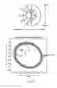 Fig. 24 - Orthovoltage radiotherapy