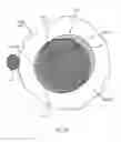 Fig. 32 - Orthovoltage radiotherapy