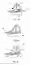 Fig. 05 - Radiotherapy chamber and method