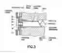 Fig. 04 - Ear-mounted transducer and ear-device
