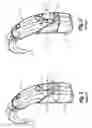 Fig. 03 - Adapter shoe and a combination of adapter shoe and hearing aid