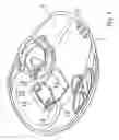 Fig. 05 - Ear cup