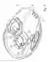 Fig. 06 - Ear cup