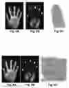 Fig. 08 - Multibiometric multispectral imager