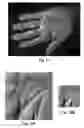 Fig. 10 - Multibiometric multispectral imager