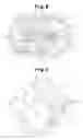 Fig. 06 - ROOTS PUMP