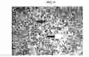 Fig. 16 - Radiolabeled Nanohybrids Targeting Solid Tumor Neovasculature and Method of Using Same