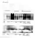 Fig. 05 - Composition for protection and improvement of skin, or reinforcing skin barrier function comprising phosphatidylserine