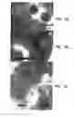 Fig. 02 - Bacteriophages that Infect Bacillus Bacteria (Anthrax)