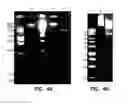 Fig. 05 - Bacteriophages that Infect Bacillus Bacteria (Anthrax)