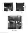 Fig. 11 - Bacteriophages that Infect Bacillus Bacteria (Anthrax)