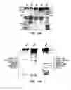 Fig. 14 - Bacteriophages that Infect Bacillus Bacteria (Anthrax)
