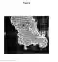 Fig. 03 - Microorganism of the genus capable of binding to and compositions comprising the same