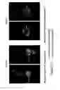 Fig. 35 - Activatable photodynamic therapy agents
