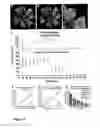 Fig. 03 - Revascularization of Ischemic Retinal Tissue and Screening Method Therefor