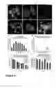 Fig. 04 - Revascularization of Ischemic Retinal Tissue and Screening Method Therefor