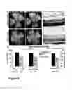 Fig. 05 - Revascularization of Ischemic Retinal Tissue and Screening Method Therefor