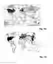 Fig. 03 - Method For Multiple Sclerosis Treatment and Prophylaxis By Treatment of Leptospira Infection