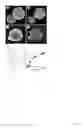 Fig. 02 - Mycoplasma subunit vaccine