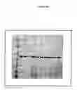 Fig. 05 - Fermentation Process for the Production of Diphtheria Toxin