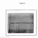 Fig. 06 - Fermentation Process for the Production of Diphtheria Toxin