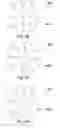 Fig. 14 - Back-up for a HPHT apparatus