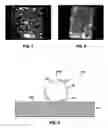 Fig. 05 - Nanoparticle implantation