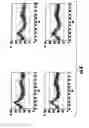Fig. 10 - Micro-molded integral non-line-of sight articles and method