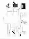 Fig. 05 - Method and system for coloring or tinting a prosthesis, and such a prosthesis