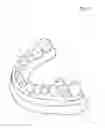 Fig. 02 - Dental Prosthesis and Its Manufacturing Method