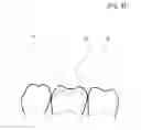 Fig. 06 - Dental Prosthesis and Its Manufacturing Method